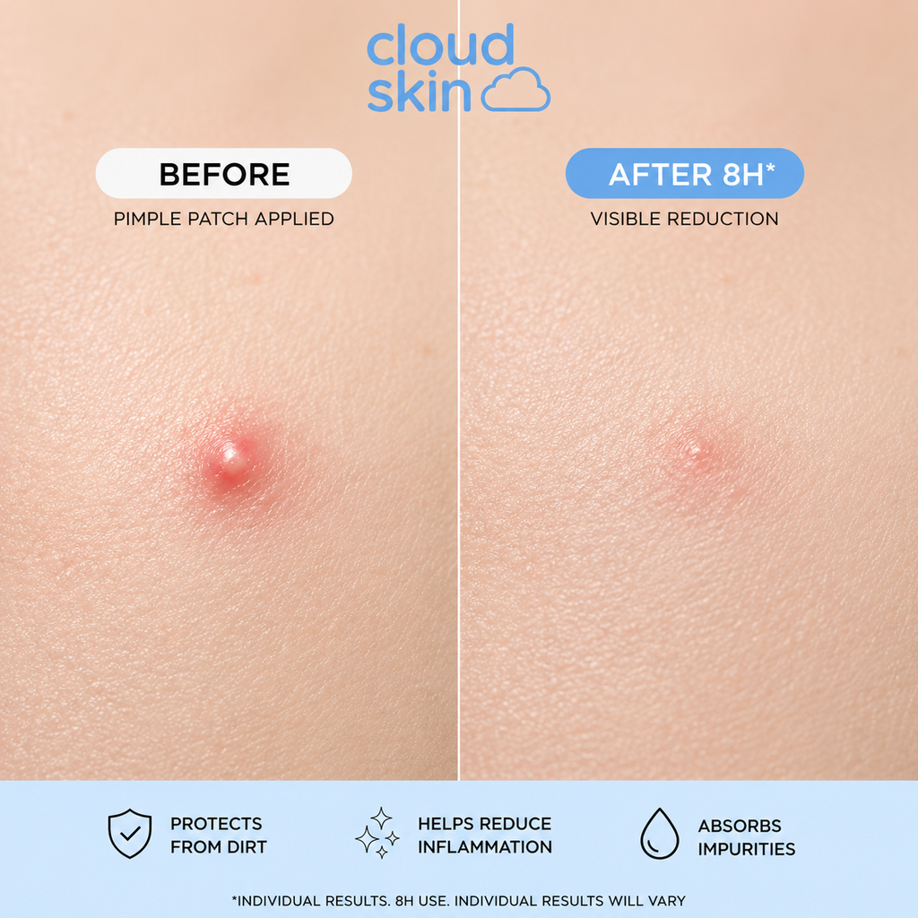 Cloud Skin Star Hydrocolloid Pimple Patches